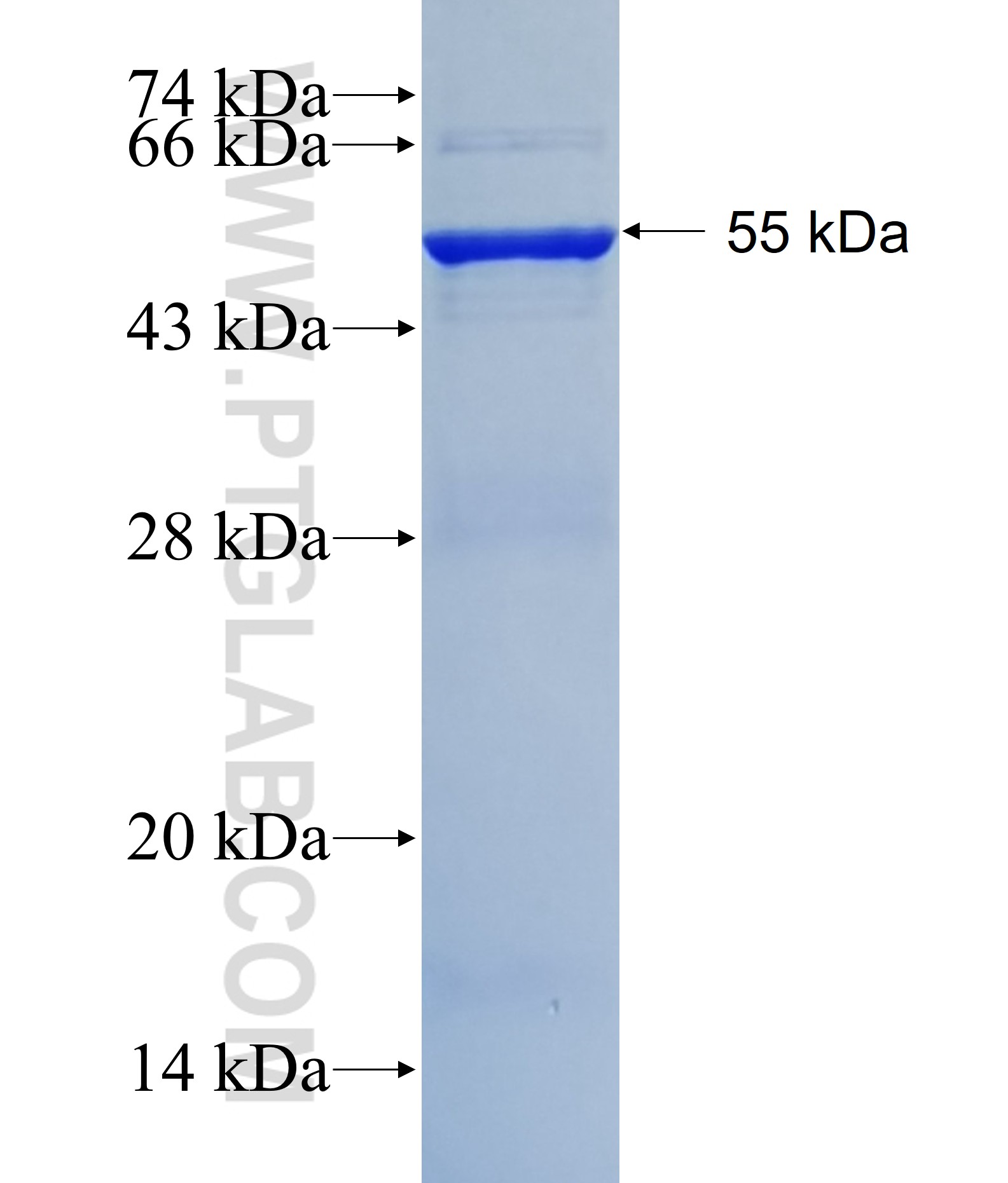 PSMB4 fusion protein Ag1500 SDS-PAGE