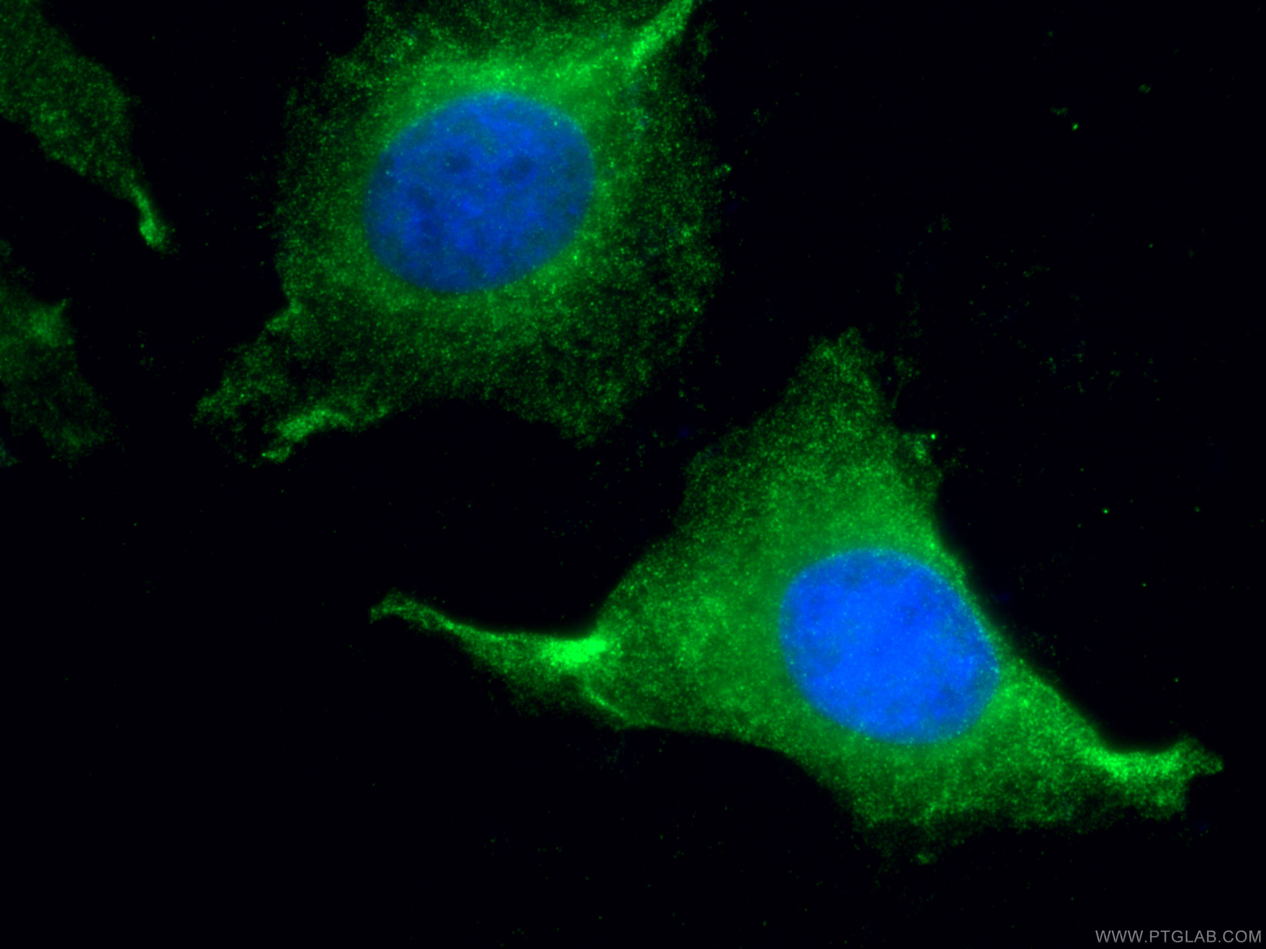 IF Staining of HeLa using 19178-1-AP