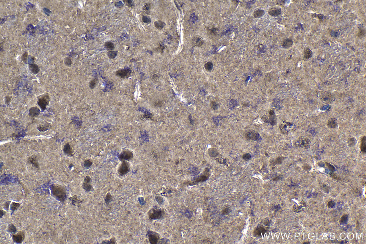 IHC staining of mouse brain using 19178-1-AP IHC staining of mouse brain using 19178-1-AP