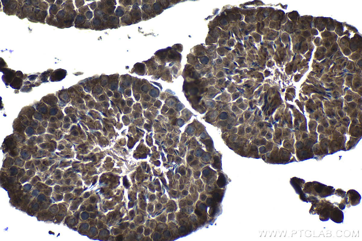 IHC staining of mouse testis using 19178-1-AP IHC staining of mouse testis using 19178-1-AP