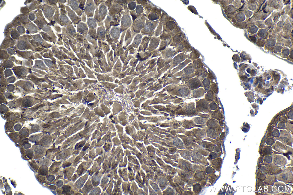 IHC staining of rat testis using 19178-1-AP IHC staining of rat testis using 19178-1-AP