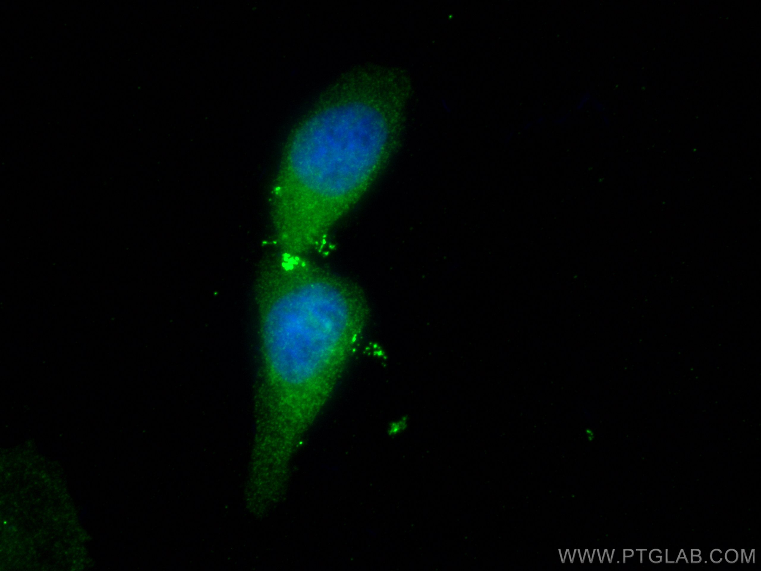 IF Staining of HeLa using 67959-1-Ig (same clone as 67959-1-PBS)