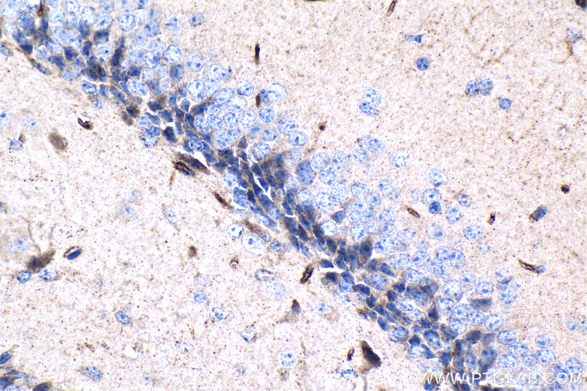 IHC staining of mouse brain using 67959-1-Ig IHC staining of mouse brain using 67959-1-Ig