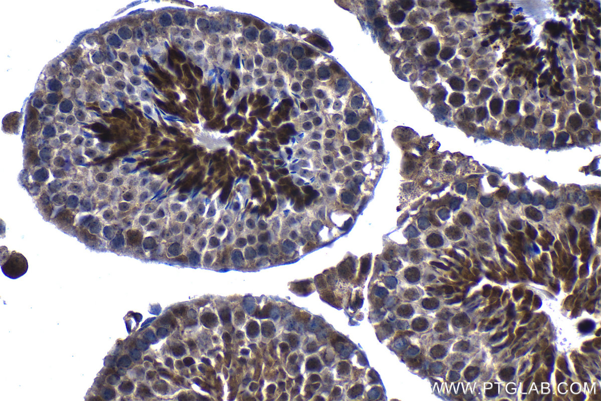 IHC staining of mouse testis using 67959-1-Ig IHC staining of mouse testis using 67959-1-Ig