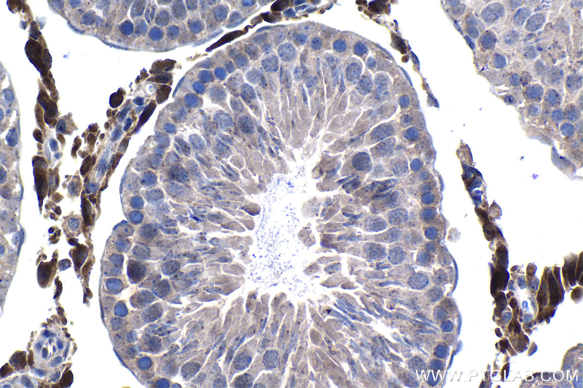 IHC staining of rat testis using 67959-1-Ig IHC staining of rat testis using 67959-1-Ig