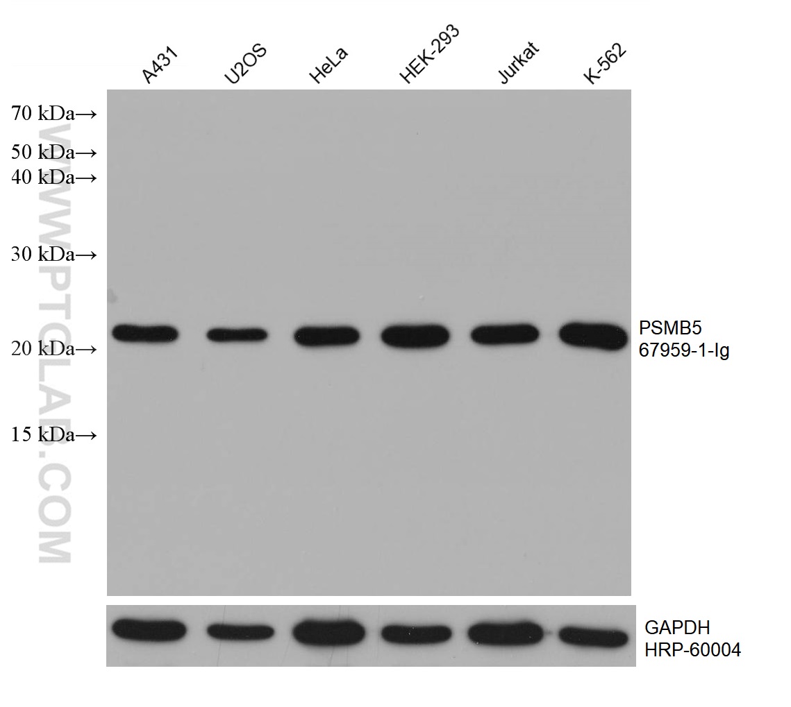 WB analysis using 67959-1-Ig (same clone as 67959-1-PBS)