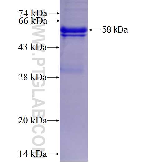 PSMB5 fusion protein Ag5230 SDS-PAGE PSMB5 fusion protein Ag5230 SDS-PAGE