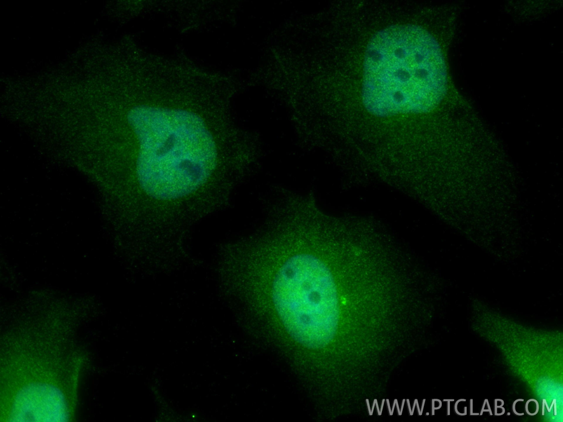 IF Staining of HeLa using 11684-2-AP IF Staining of HeLa using 11684-2-AP