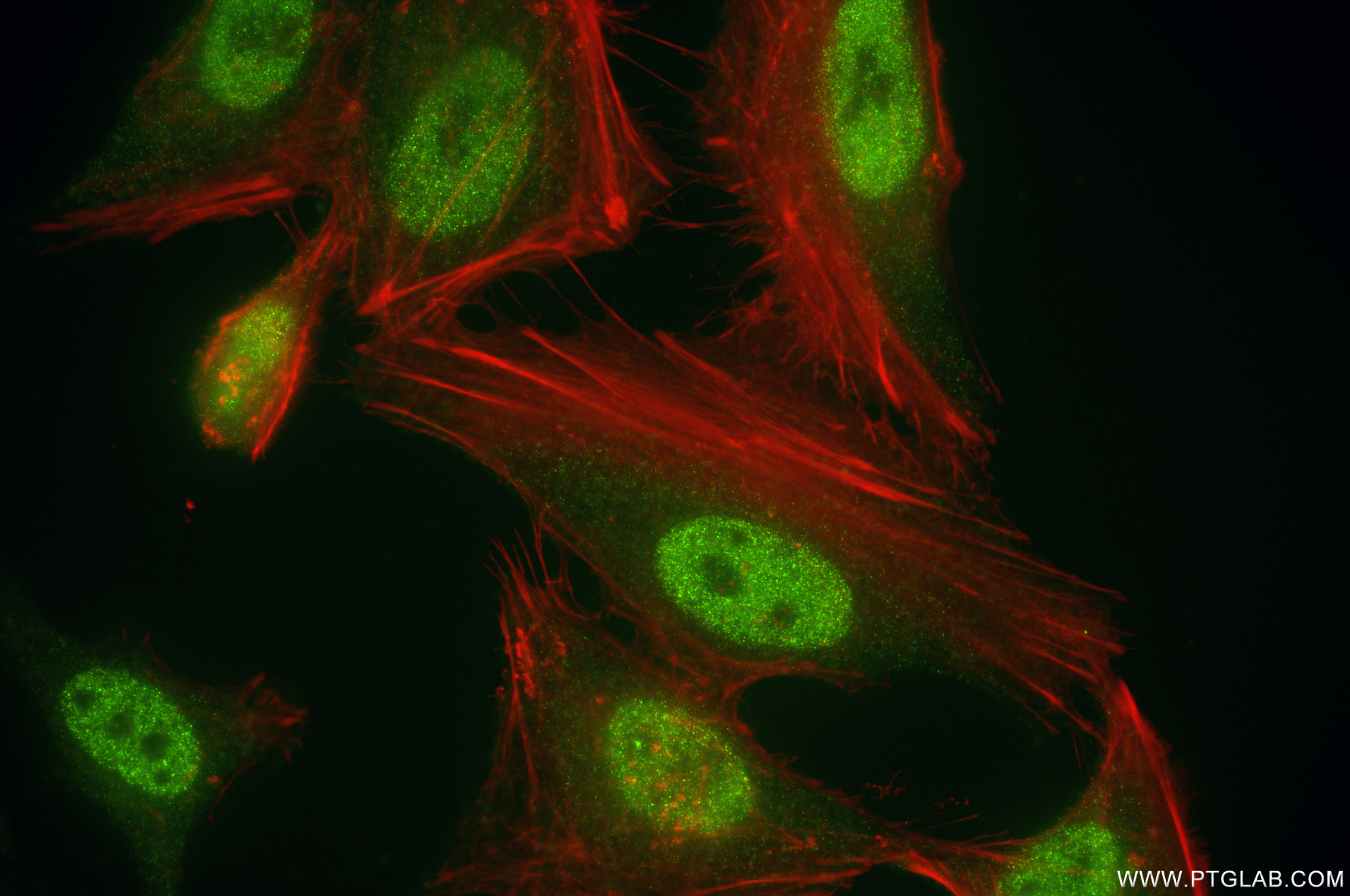 IF Staining of HeLa using 86491-1-RR