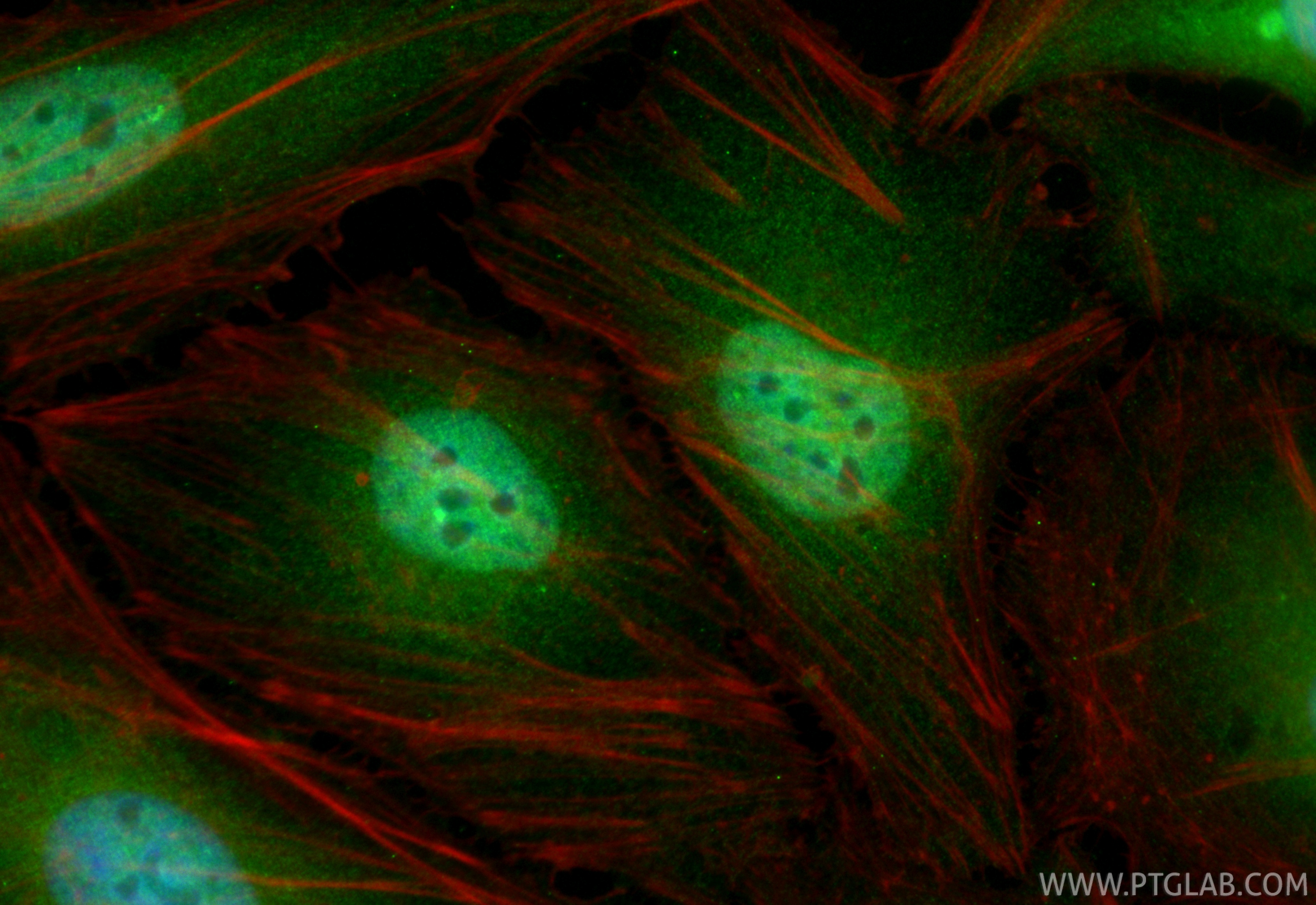 IF Staining of HeLa using CL488-86491