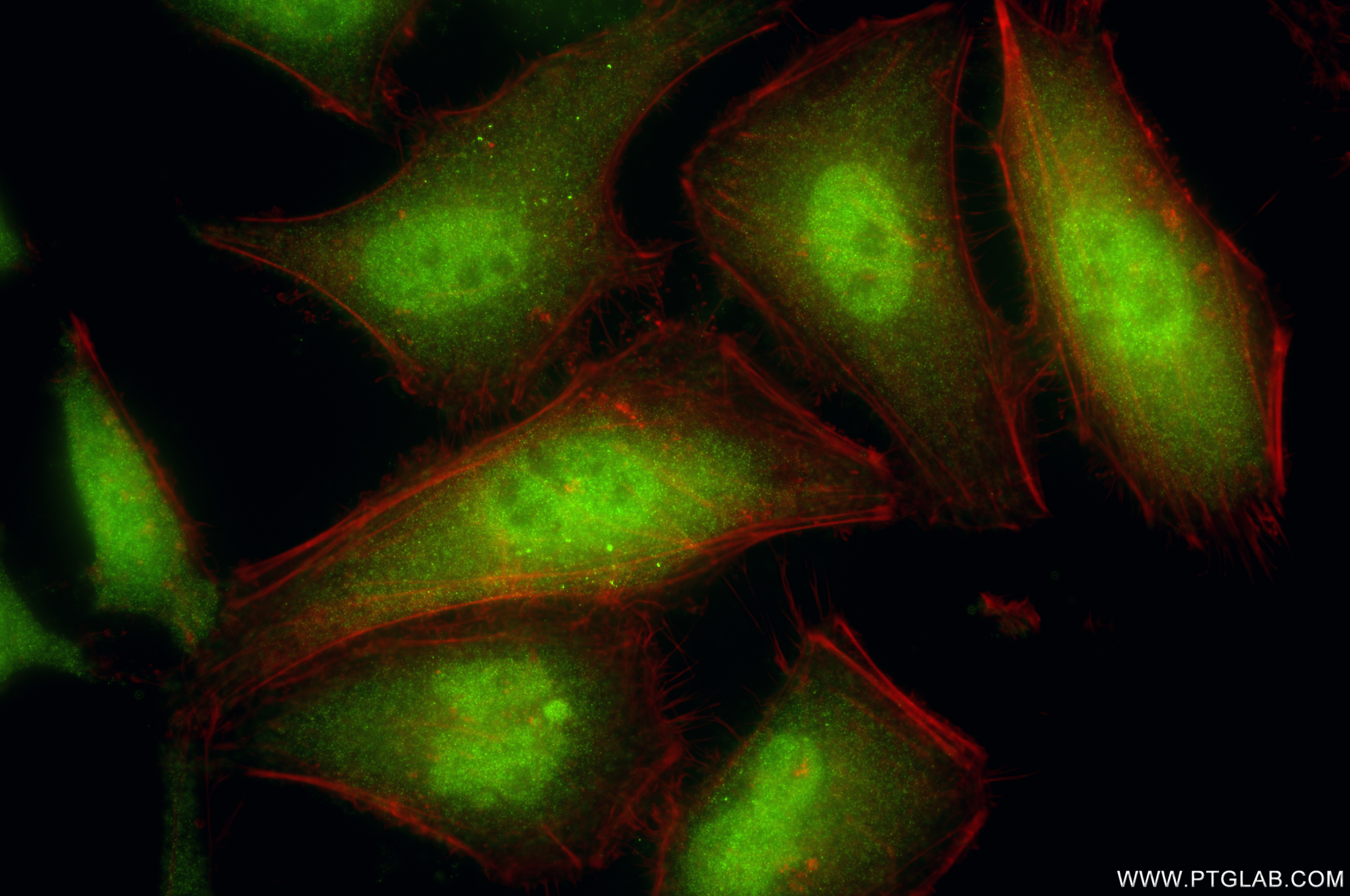 IF Staining of HeLa using 86241-1-RR
