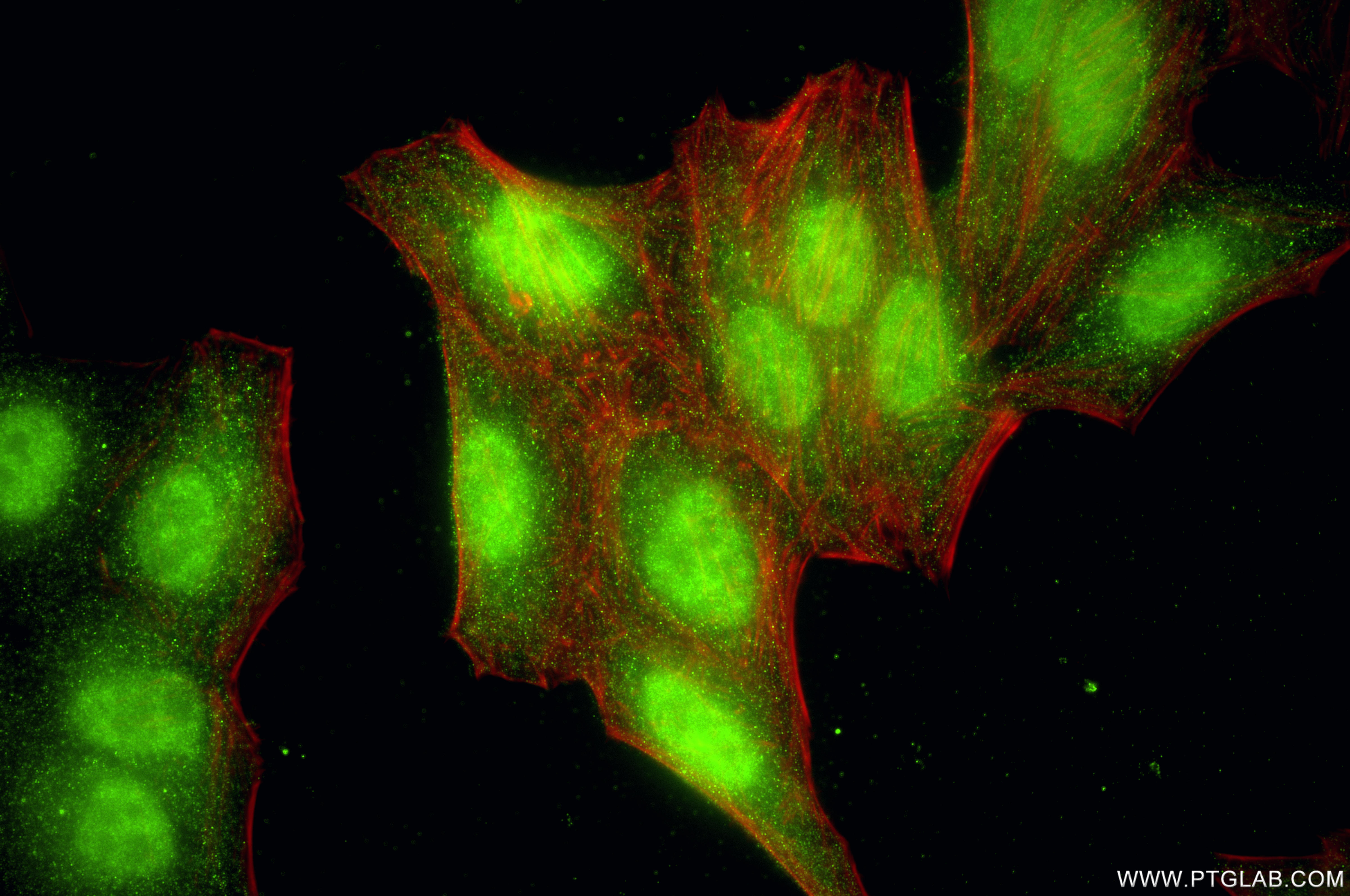 IF Staining of HepG2 using 87013-2-RR IF Staining of HepG2 using 87013-2-RR