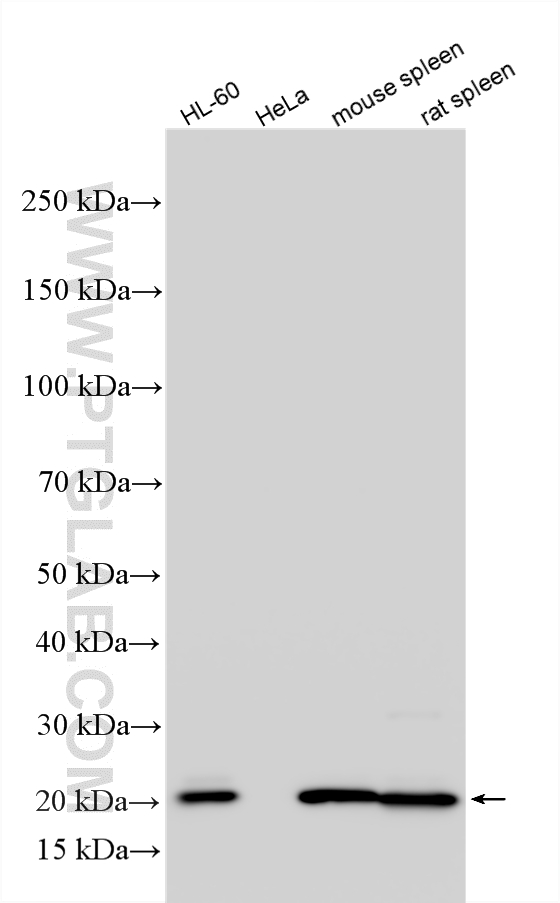 WB analysis using RMX00091 WB analysis using RMX00091