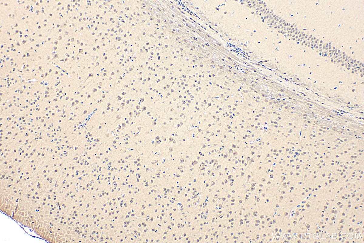 IHC staining of mouse brain using 14905-1-AP