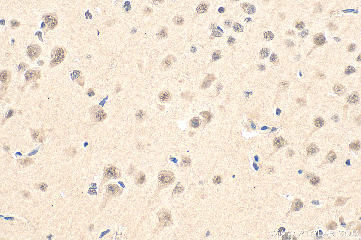 IHC staining of mouse brain using 14905-1-AP