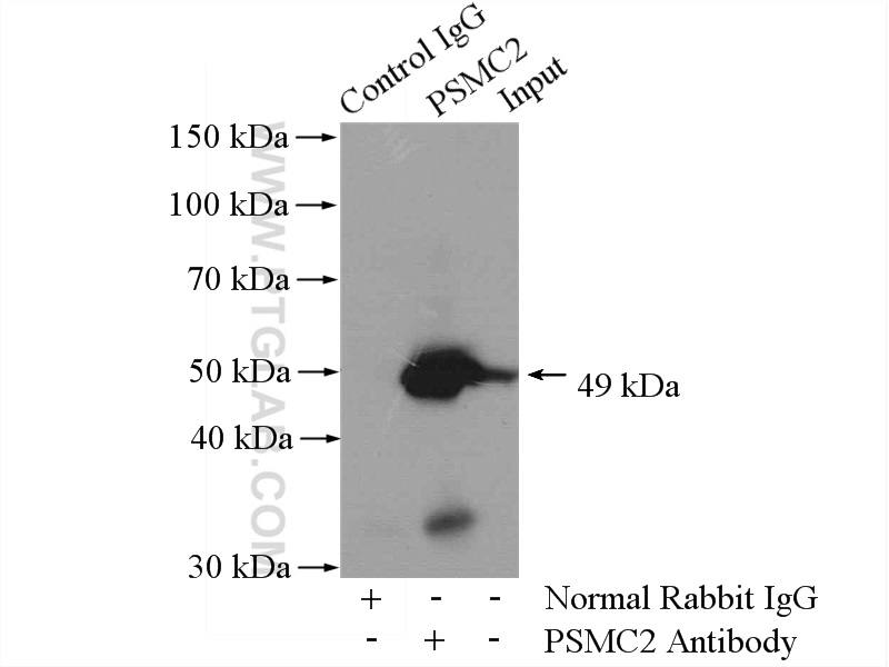IP experiment of mouse spleen using 14905-1-AP