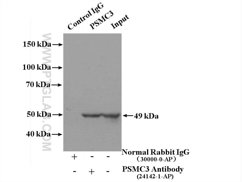 IP experiment of HeLa using 24142-1-AP