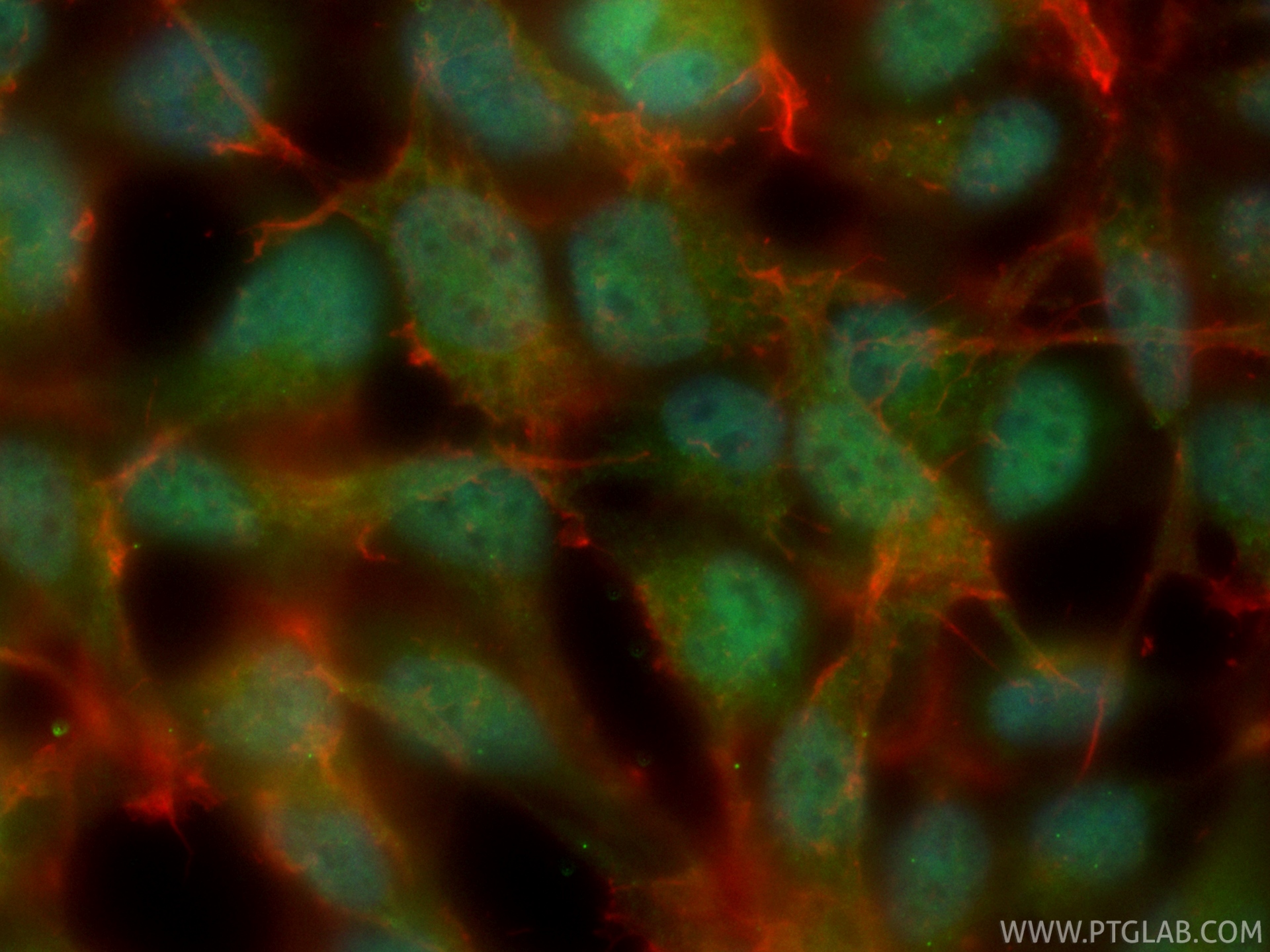 IF Staining of HEK-293 using CL488-87128-4 IF Staining of HEK-293 using CL488-87128-4