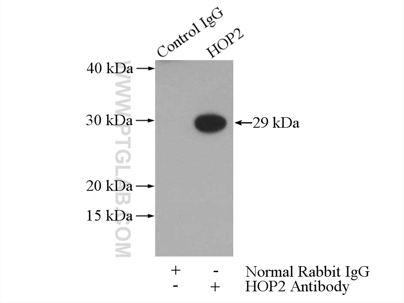 IP experiment of Jurkat using 11339-1-AP