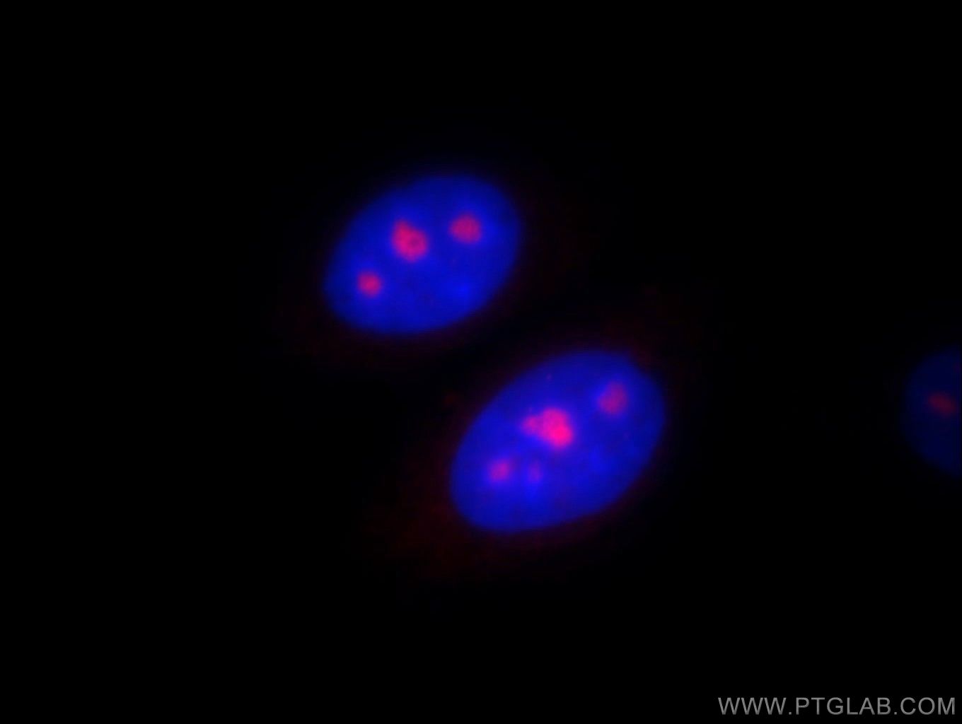 IF Staining of HepG2 using 11389-1-AP