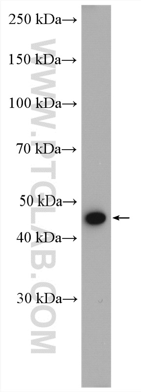 PSMC5