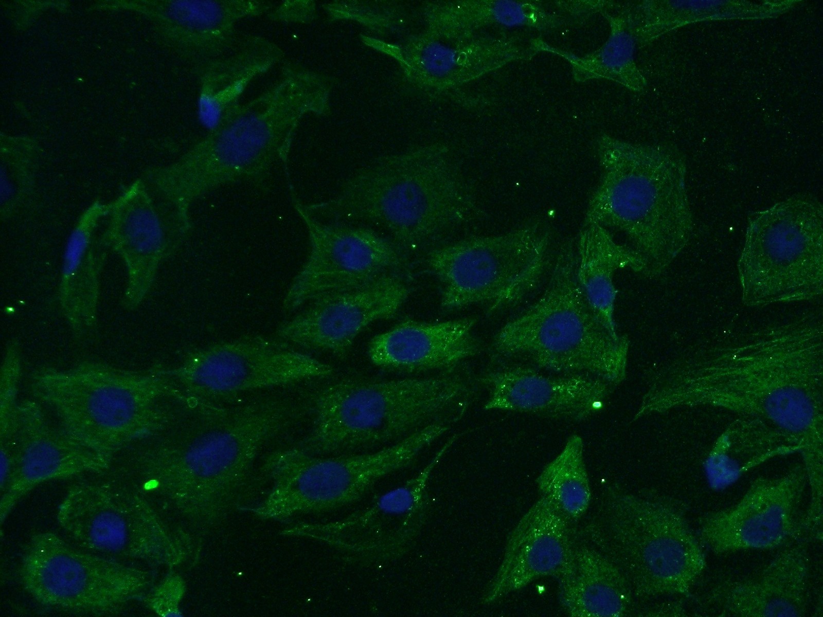 PSMC6 Polyclonal antibody