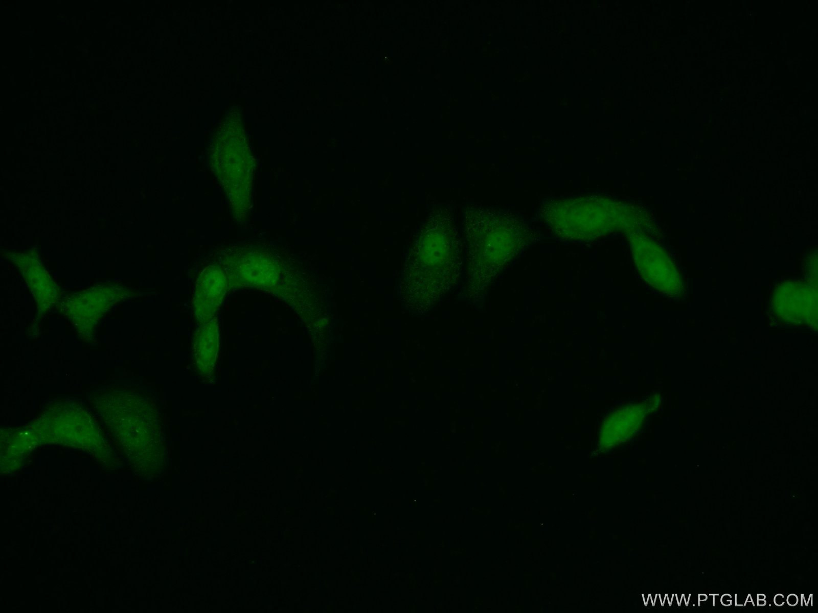 PSMD11 Polyclonal antibody