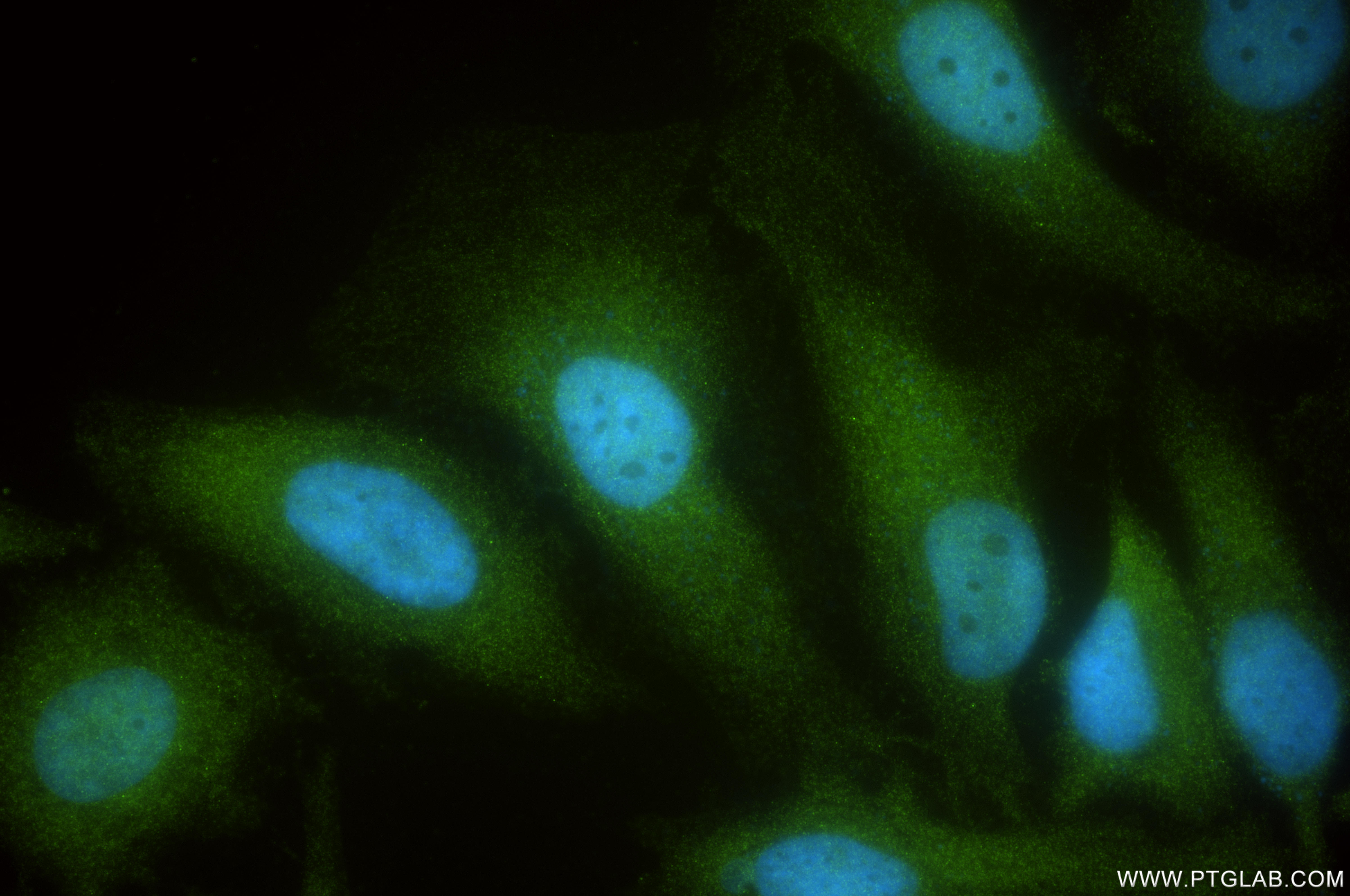 IF Staining of HeLa using 86596-3-RR