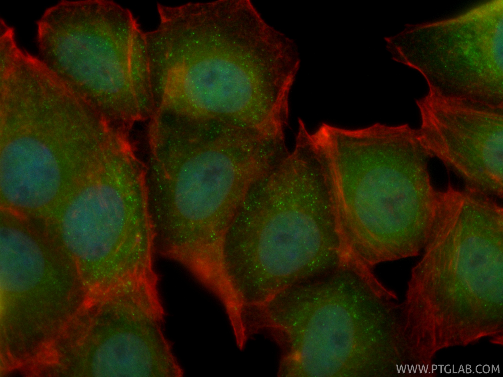 IF Staining of MCF-7 using CL488-86596-3
