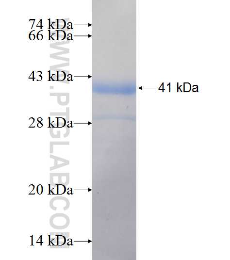 PSMD11 fusion protein Ag6879 SDS-PAGE PSMD11 fusion protein Ag6879 SDS-PAGE