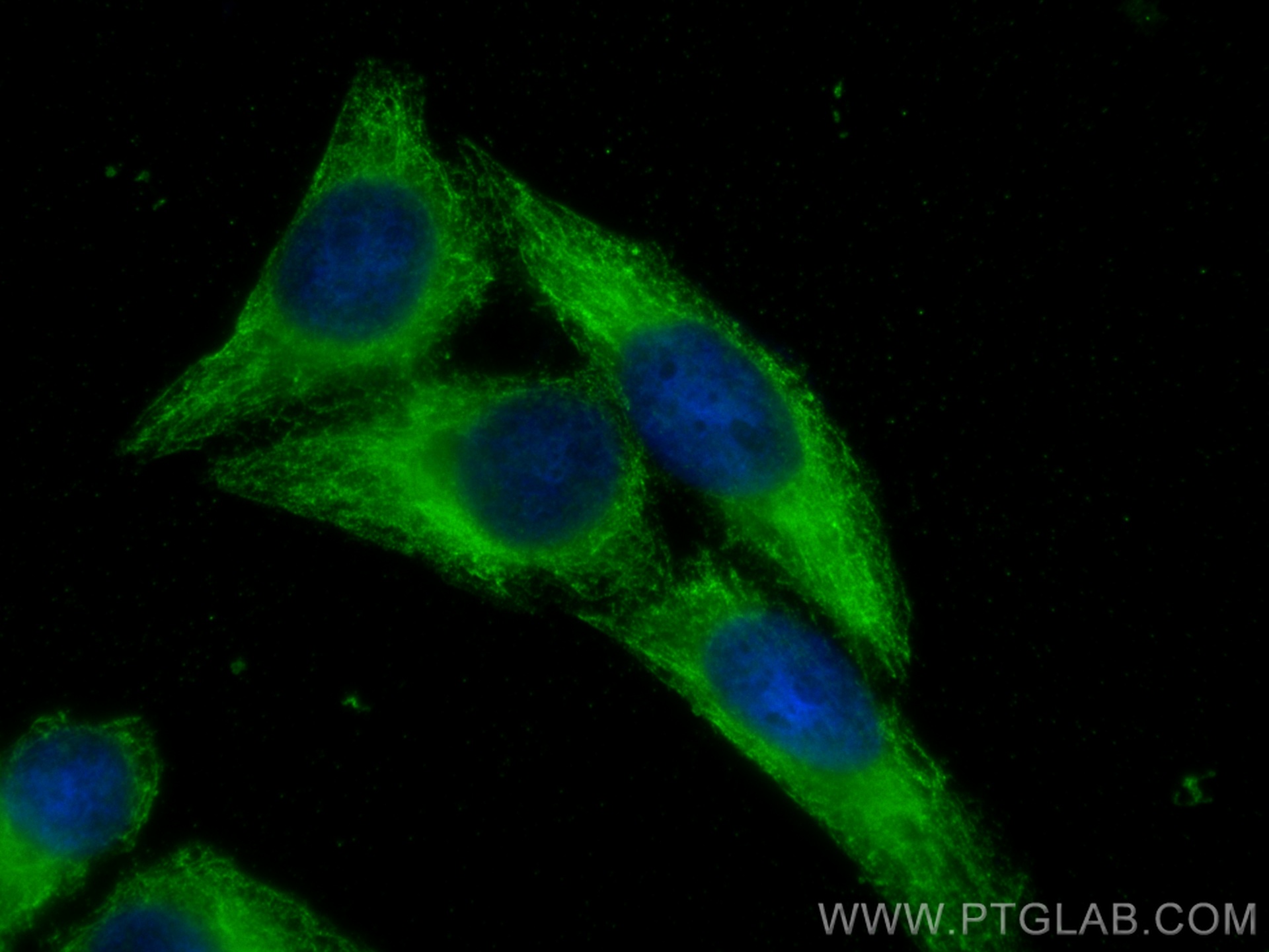 IF Staining of HepG2 using 67807-1-Ig