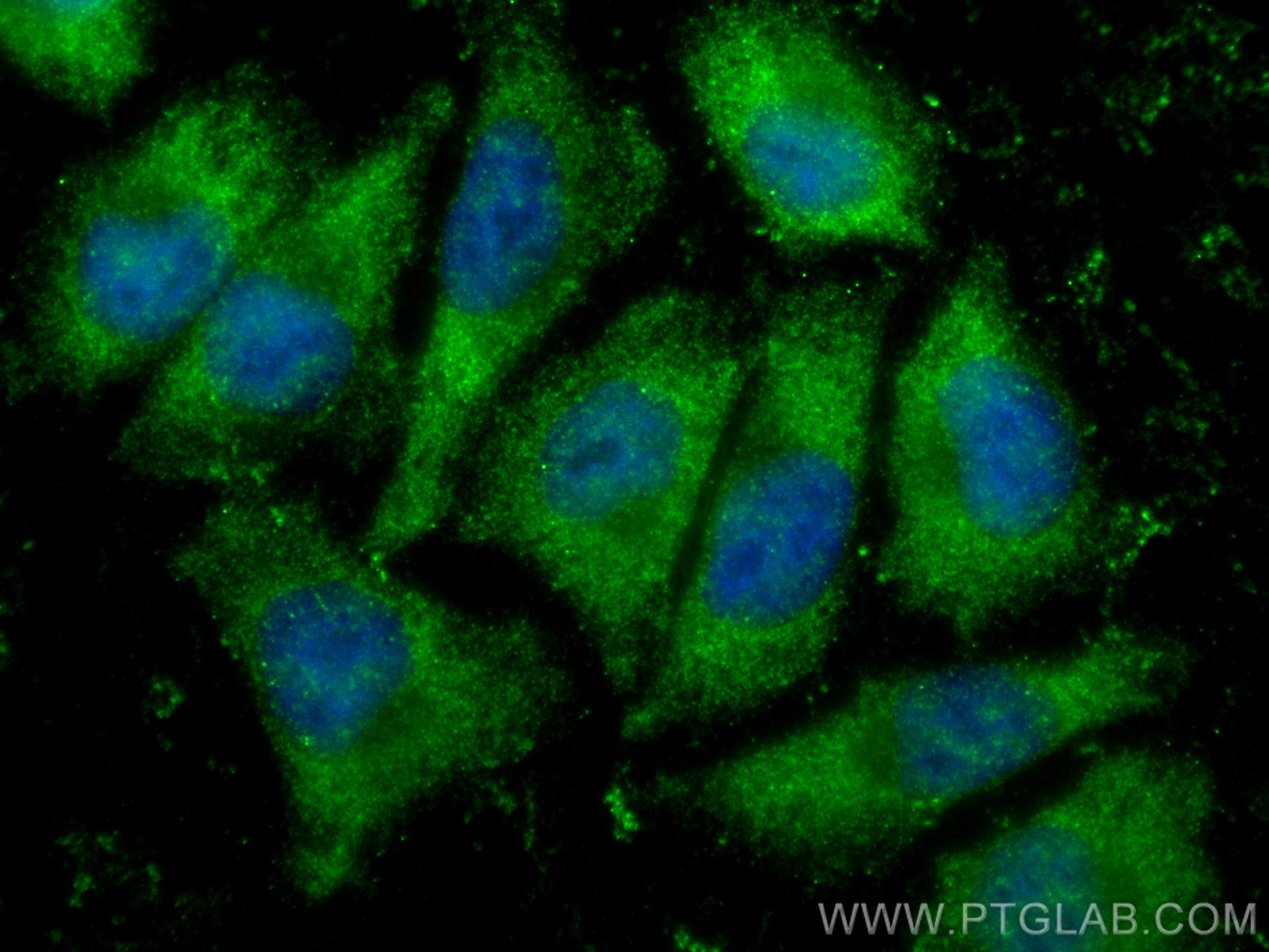 IF Staining of A375 using 12059-1-AP