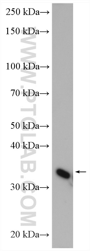 WB analysis of rat heart using 12059-1-AP