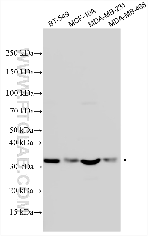 Various lysates were subjected to SDS PAGE followed by western blot with 12059-1-AP (PSMD14/POH1 antibody) at dilution of 1:1000 incubated at room temperature for 1.5 hours. WB analysis using 12059-1-AP