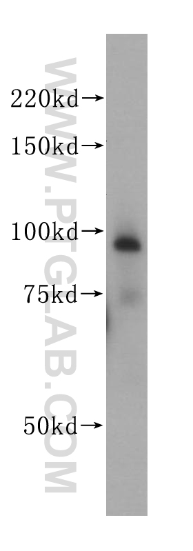 PSMD2 Polyclonal antibody