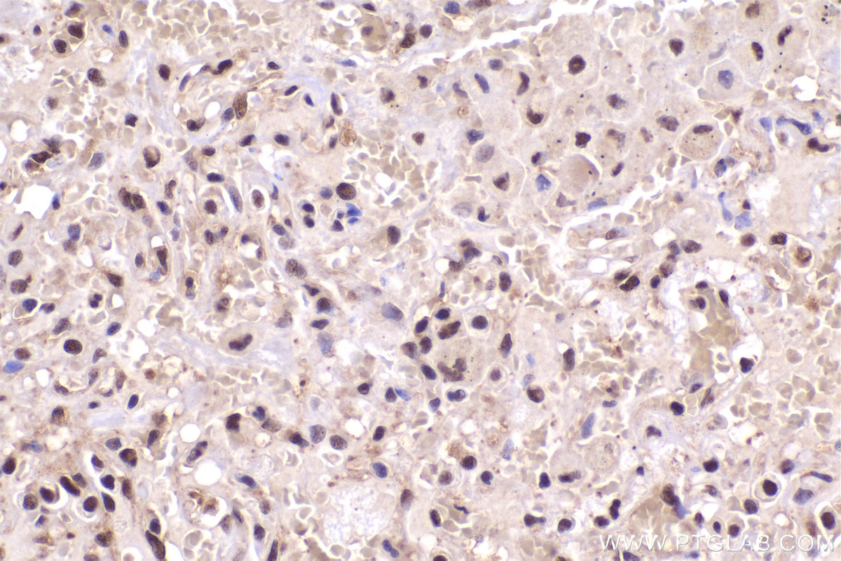 IHC staining of human lung using 67770-1-Ig (same clone as 67770-1-PBS)