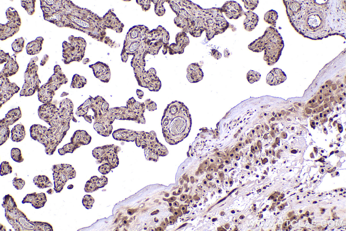 IHC staining of human placenta using 67770-1-Ig (same clone as 67770-1-PBS)