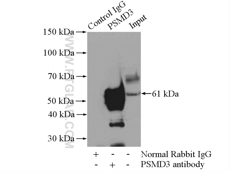 IP experiment of mouse kidney using 12054-1-AP
