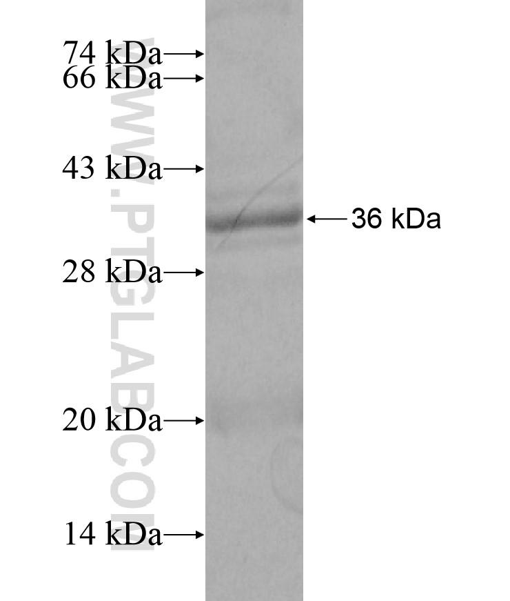 PSMD3 fusion protein Ag17174 SDS-PAGE PSMD3 fusion protein Ag17174 SDS-PAGE