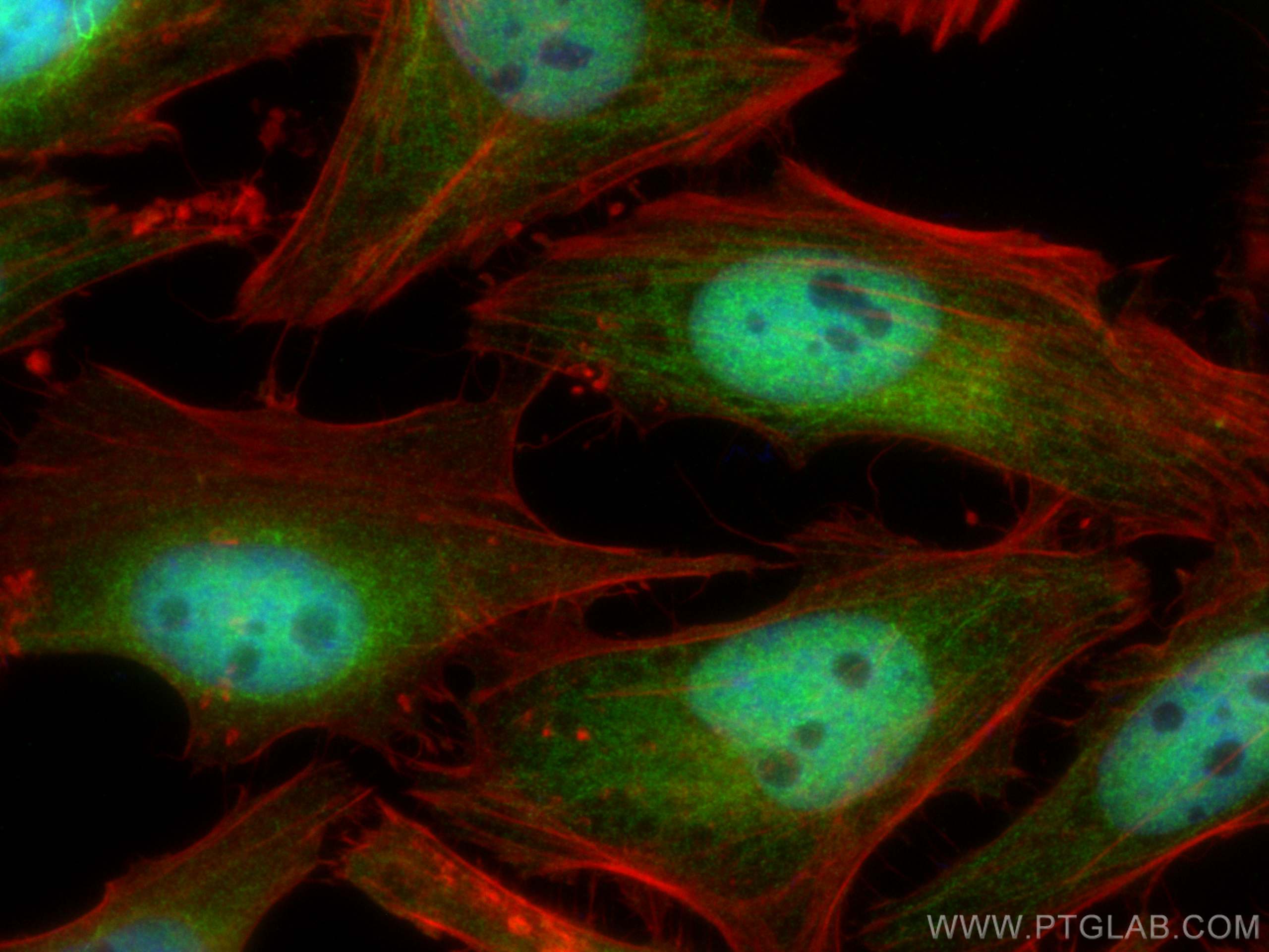 IF Staining of HeLa using 66179-1-Ig