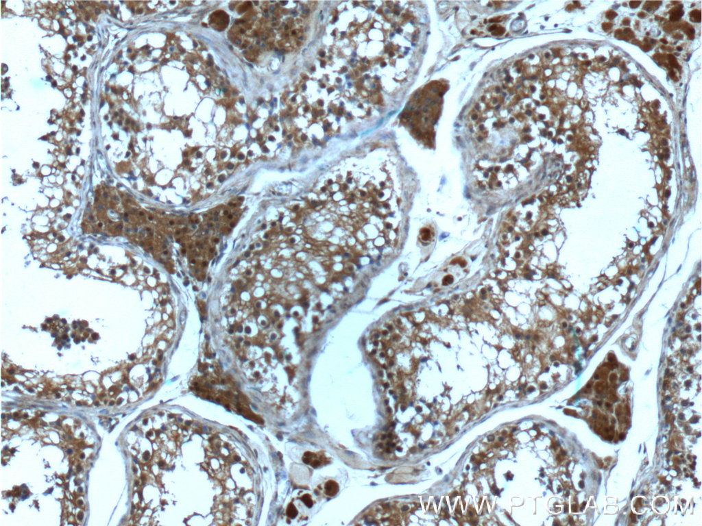 IHC staining of human testis using 66179-1-Ig