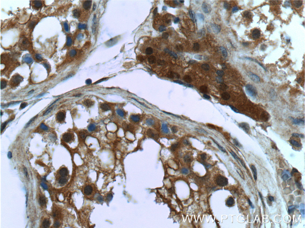 IHC staining of human testis using 66179-1-Ig