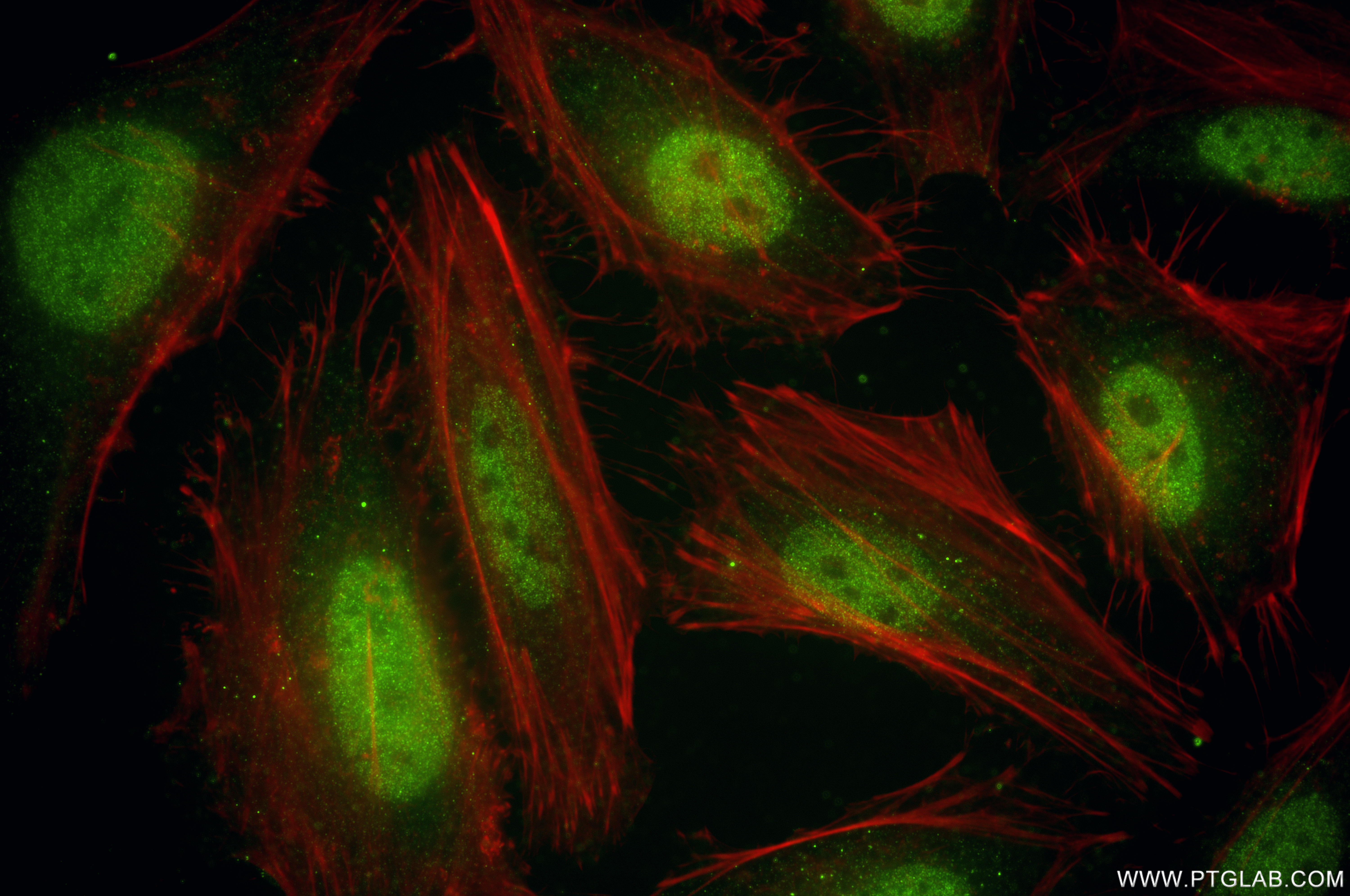 IF Staining of HeLa using 86558-1-RR
