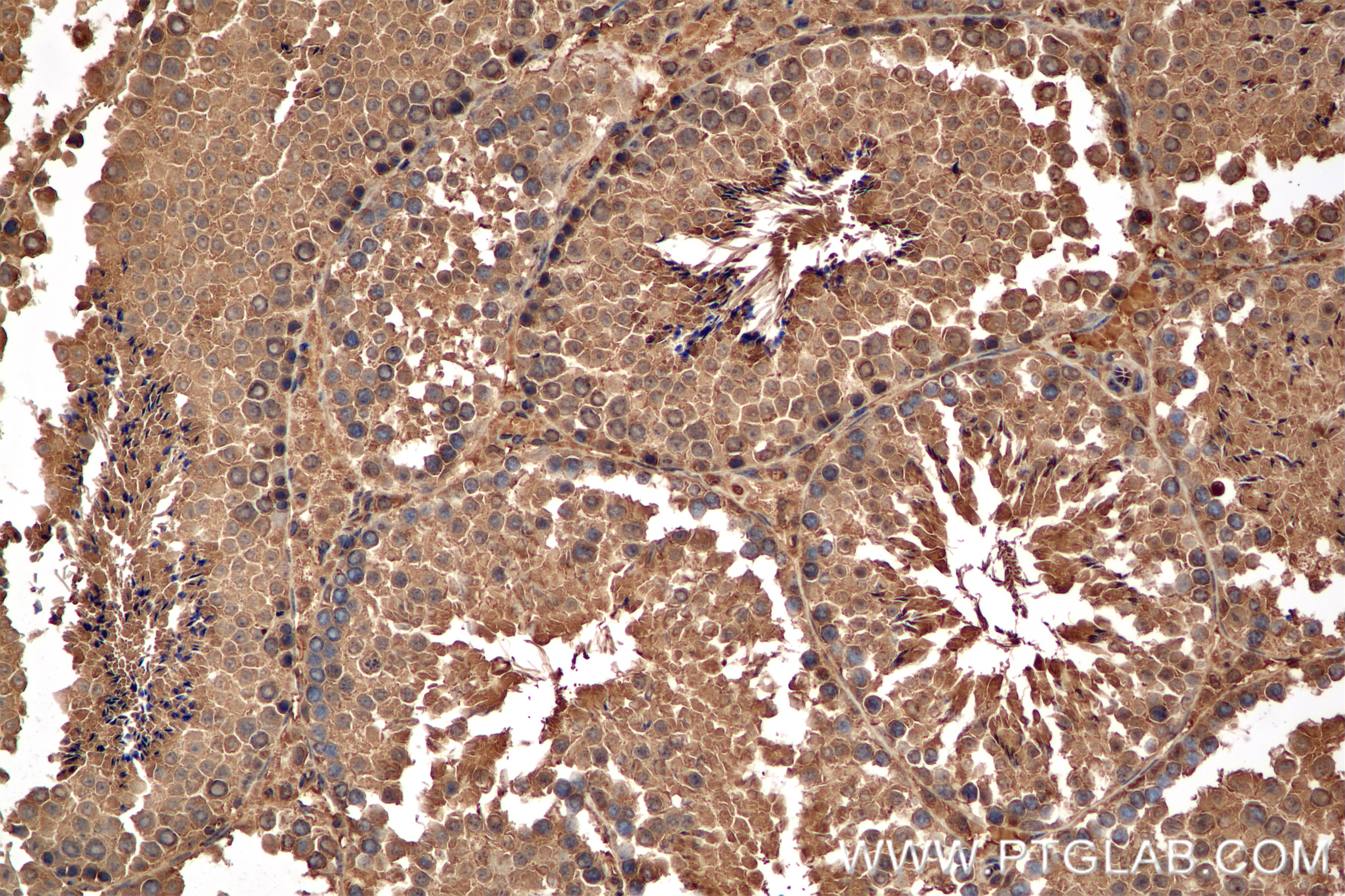 IHC staining of mouse testis using 86558-1-RR