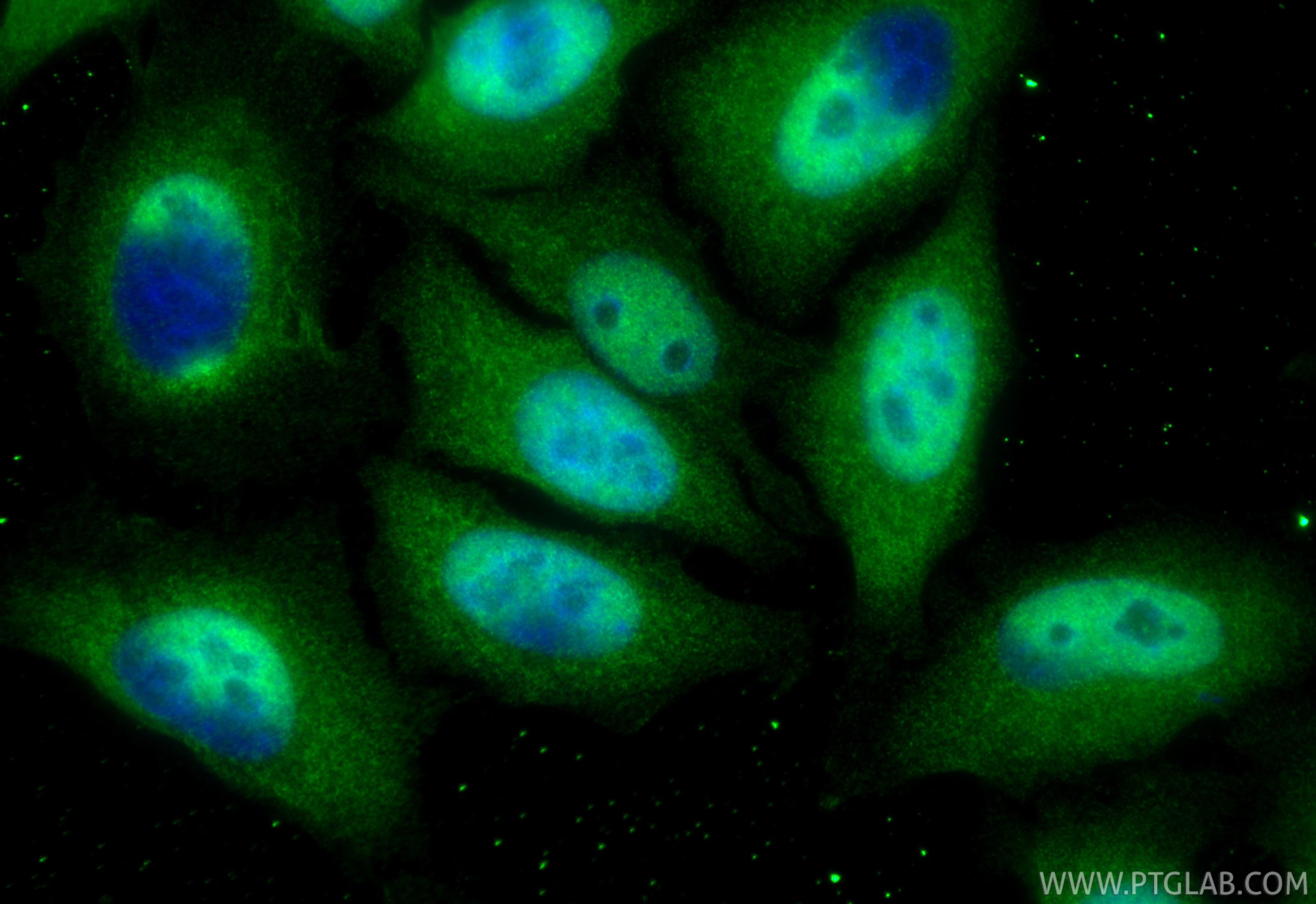 IF Staining of HepG2 using RMX00058 IF Staining of HepG2 using RMX00058