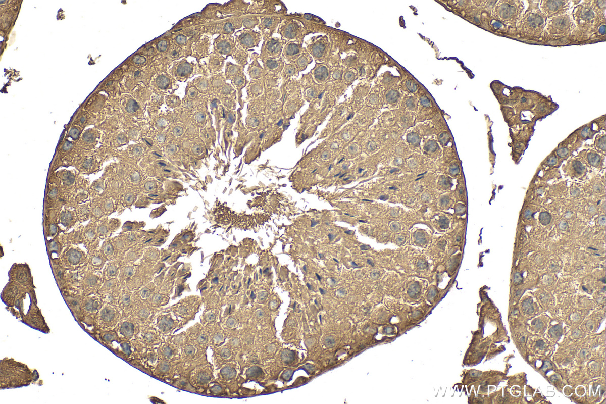 IHC staining of mouse testis using RMX00058 IHC staining of mouse testis using RMX00058