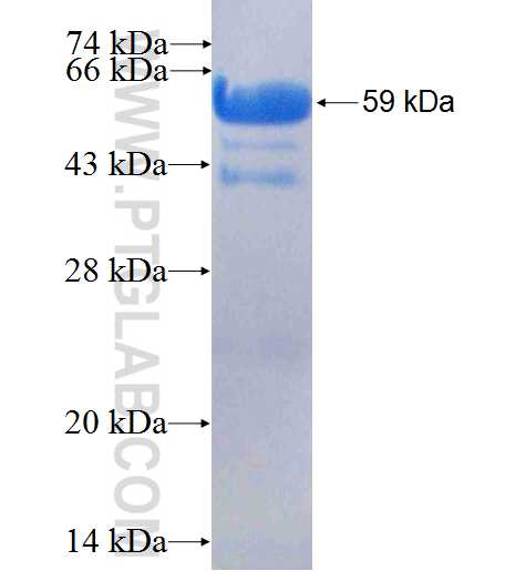 PSMD4 fusion protein Ag7010 SDS-PAGE