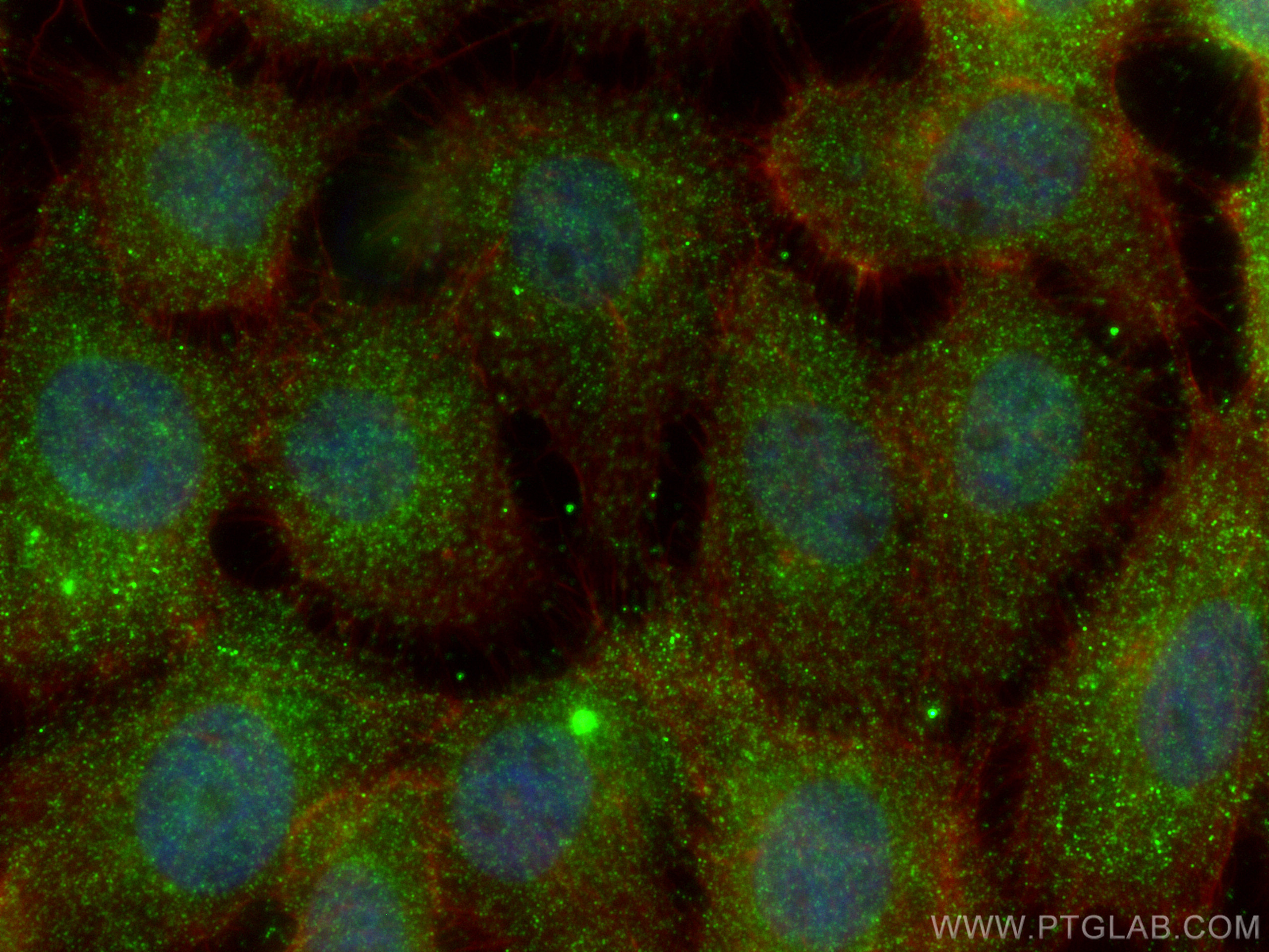 IF Staining of A431 using 67682-1-Ig (same clone as 67682-1-PBS)