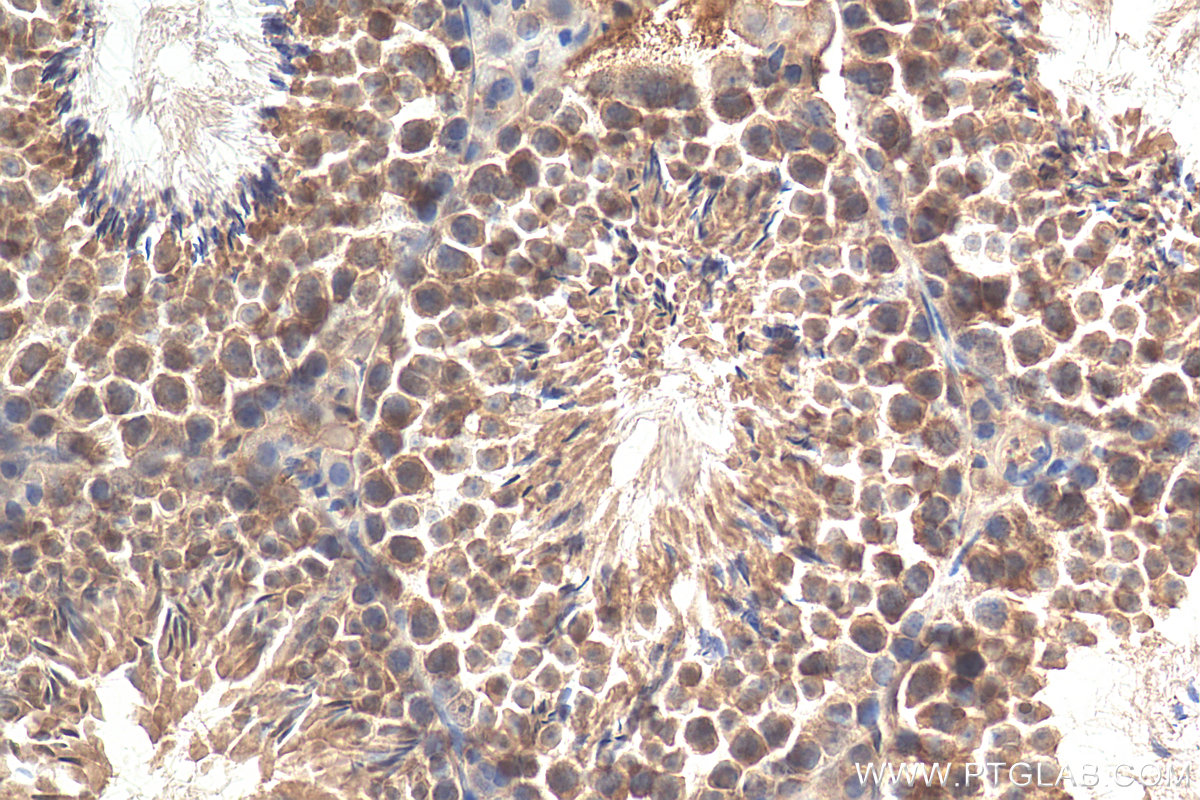 IHC staining of mouse testis using 12539-1-AP