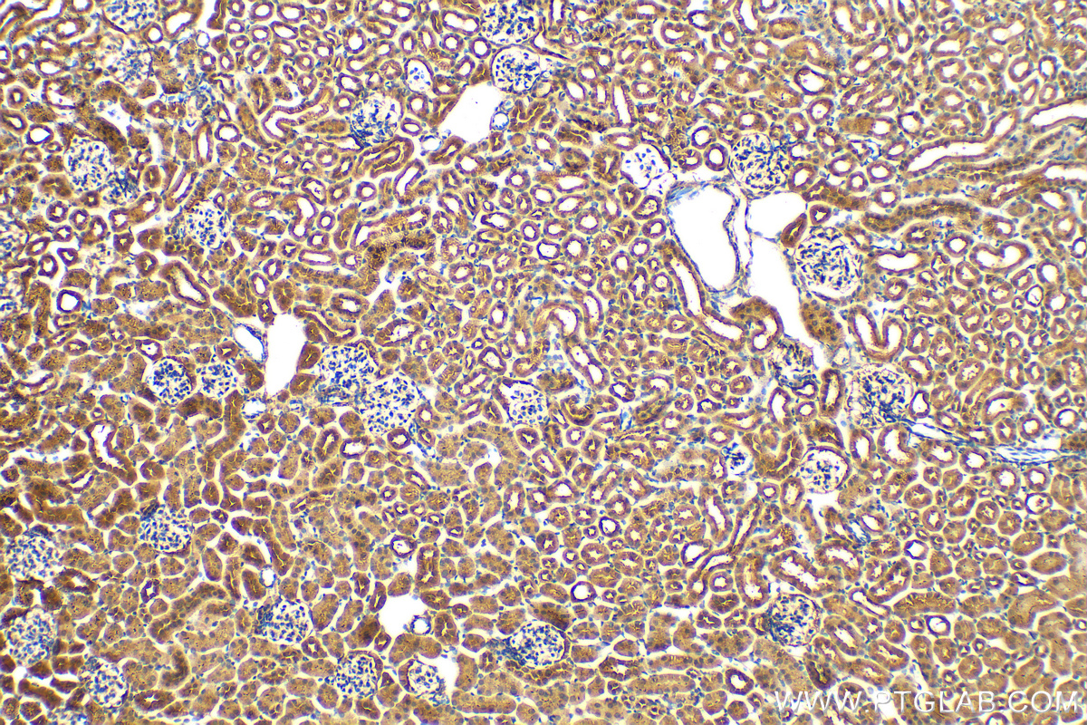 IHC staining of mouse kidney using 12539-1-AP